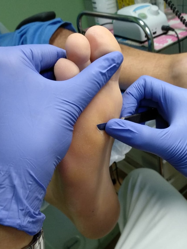 Profesional Podólogo en Madrid